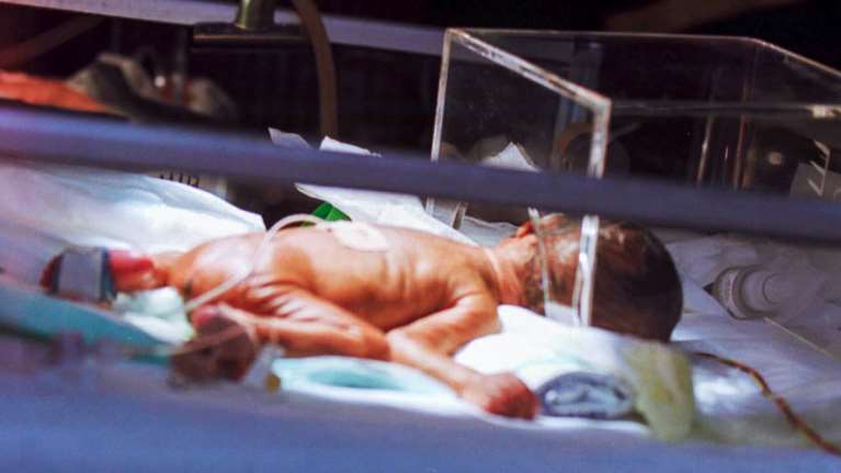 Οξεία ηπατίτιδα: Συναγερμός στον ΕΟΔΥ για τρία πιθανά κρούσματα σε παιδιά στην Ελλάδα - Τα συμπτώματά τους