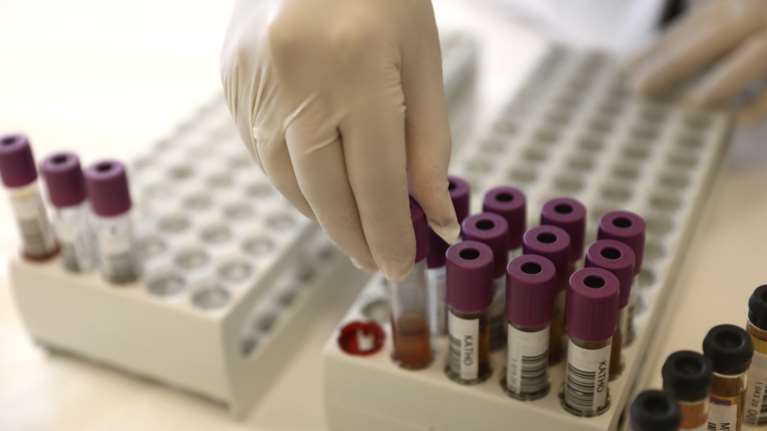 Κορονοϊός: Μέχρι πότε έχουμε αντισώματα - Το debate των επιστημόνων