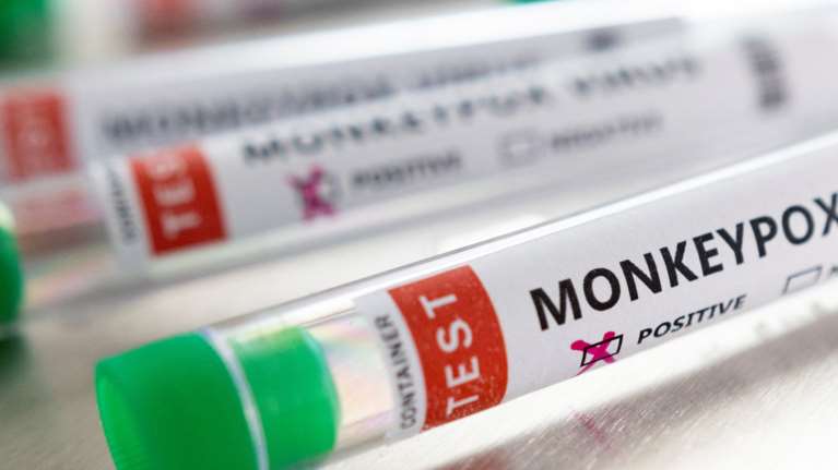 Ευλογιά των πιθήκων: Έφτασαν τα 39 τα κρούσματα στην Ελλάδα - Όλοι άντρες ηλικίας από 29 έως 59 ετών