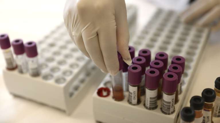 Ξεκινά στην Ελλάδα η κλινική μελέτη για το ισραηλινό φάρμακο κατά του κορονοϊού - Θα είναι εισπνεόμενο