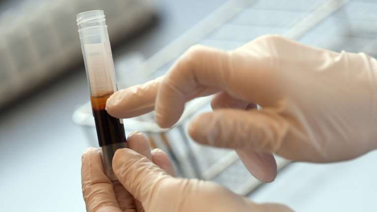 Κορονοϊός: Ξεκινά πειραματικά η χορήγηση αντισωμάτων στην Ελλάδα - Τι είπε ο Τσιόδρας