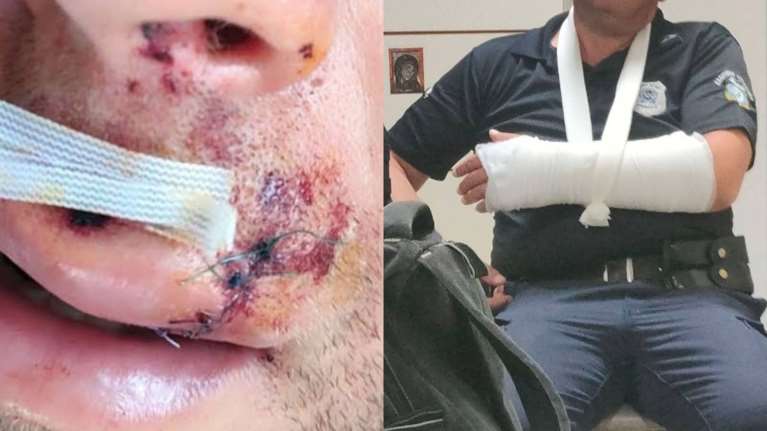 Άγριο περιστατικό στη Λάρισα:  20 άτομα επιτέθηκαν και τραυμάτισαν 2 αστυνομικούς