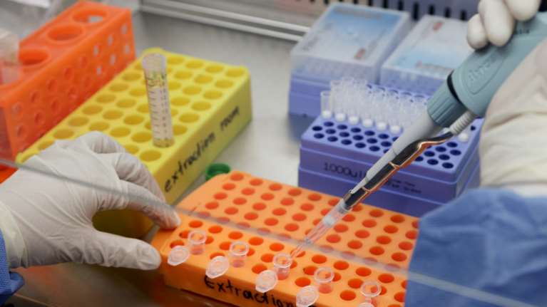 Κορονοϊός: Σήμερα οι ανακοινώσεις για το πολλά υποσχόμενο εμβόλιο της Οξφόρδης