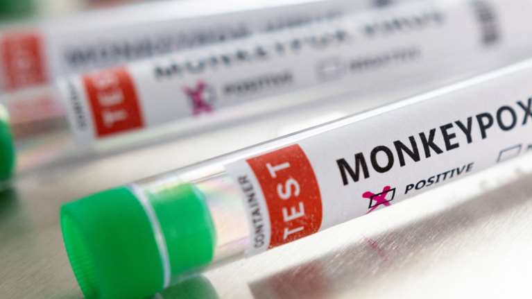 Δεύτερο κρούσμα της ευλογιάς των πιθήκων στην Ελλάδα - Άνδρας με πρόσφατο ταξίδι στην Ισπανία σύμφωνα με τον ΕΟΔΥ