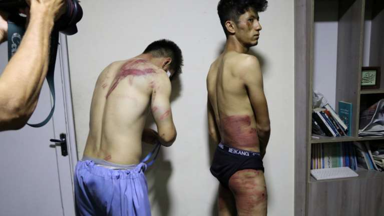 Αφγανιστάν: Ταλιμπάν βασάνισαν άγρια δύο δημοσιογράφους - Σκληρές εικόνες και βίντεο