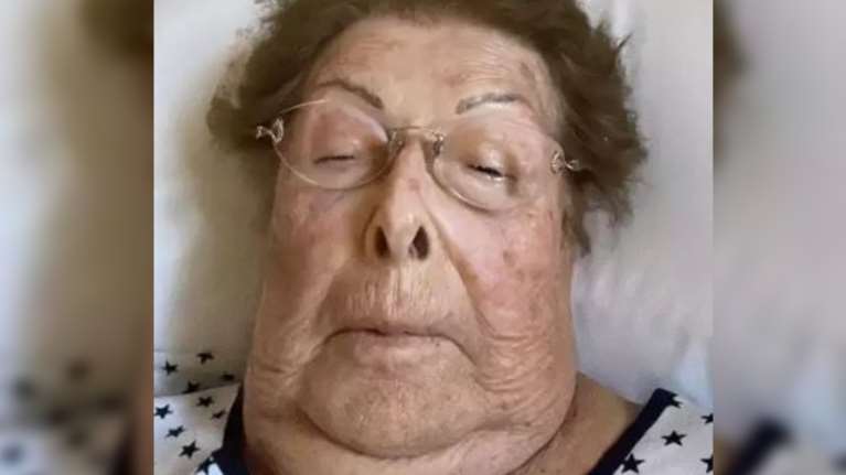 Βέφα Αλεξιάδου: Αγνώριστη στο νοσοκομείο η αγαπημένη μαγείρισσα [εικόνα]