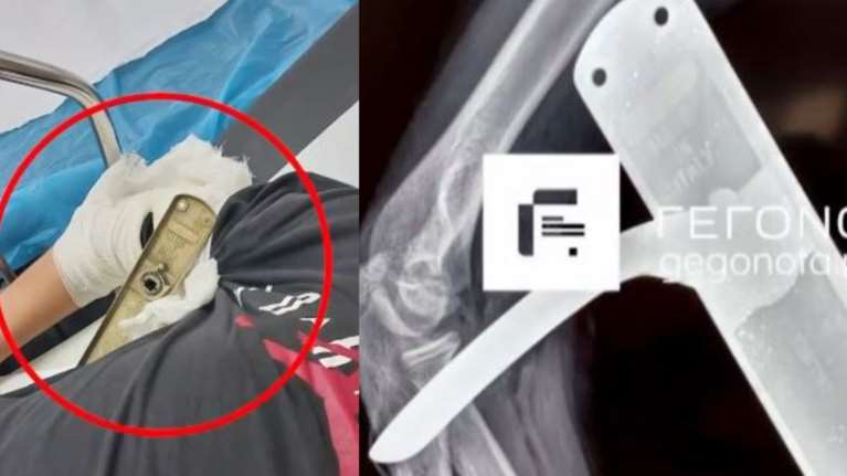 Βόλος: Πώς το πόμολο της πόρτας καρφώθηκε στο χέρι μαθητή - &quot;Έγινε αυτό που λέμε, ο νόμος του Μέρφι&quot; [Βίντεο]