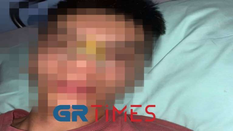 Σοκ στη Θεσσαλονίκη: 14χρονος έπεσε θύμα ξυλοδαρμού από συνομηλίκους του χωρίς λόγο