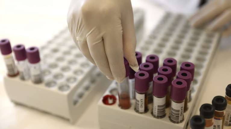 Κορονοϊός: Για πρώτη φορά στη χώρα το στέλεχος ΒΑ.5 της μετάλλαξης Όμικρον - Πιο μεταδοτικό και διαφεύγει της ανοσίας