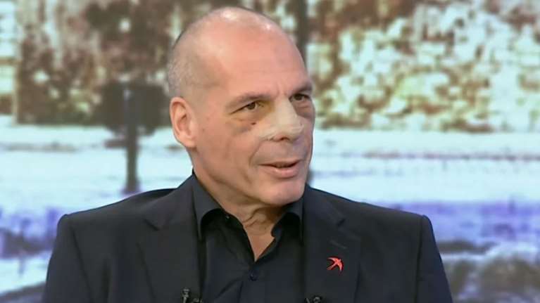 Πρώτη δημόσια εμφάνιση Βαρουφάκη με σπασμένη μύτη: Τσιλιαδόρος ο 17χρονος, χειρουργικά τα χτυπήματα