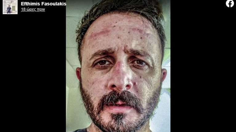 Συγκλονίζει γιατρός σε νοσοκομείο της Κρήτης: Την μάσκα που εσύ αρνείσαι να φορέσεις, εμείς παρακαλάμε να έχουμε