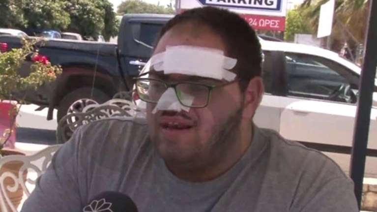 Παρέμβαση Γεωργιάδη για τον εγκαυματία μάγειρα στην Κρήτη: Τον έβαλαν σε δωμάτιο με ωμά κρέατα επειδή ήταν ανασφάλιστος