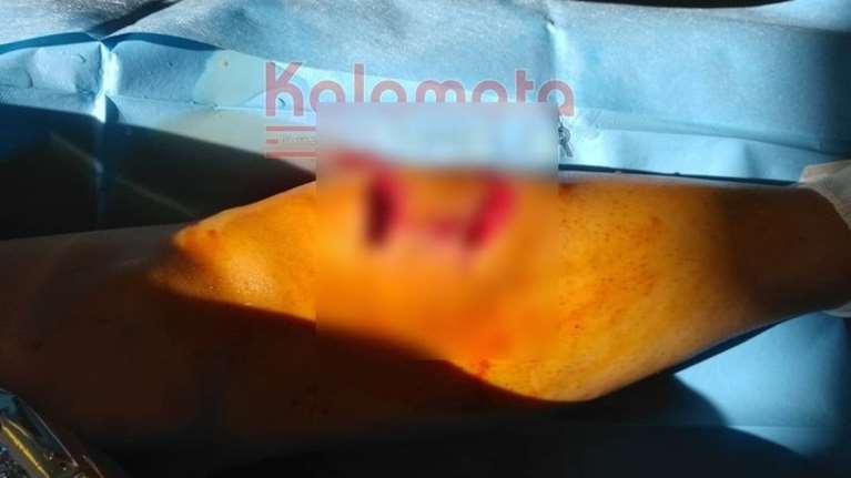 Καλαμάτα: Επίθεση σκύλων σε 34χρονη μητέρα - Σοκαριστικές φωτογραφίες από τα τραύματα