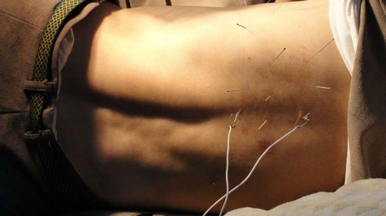 Η παραδοσιακή κινεζική ιατρική παίζει σημαντικό ρόλο στο σύστημα υγείας