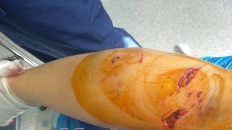 Ξεσπά ο σύζυγος της 34χρονης που έπεσε θύμα αγέλης σκύλων - &quot;Δεν επενέβη ποτέ η αστυνομία&quot;