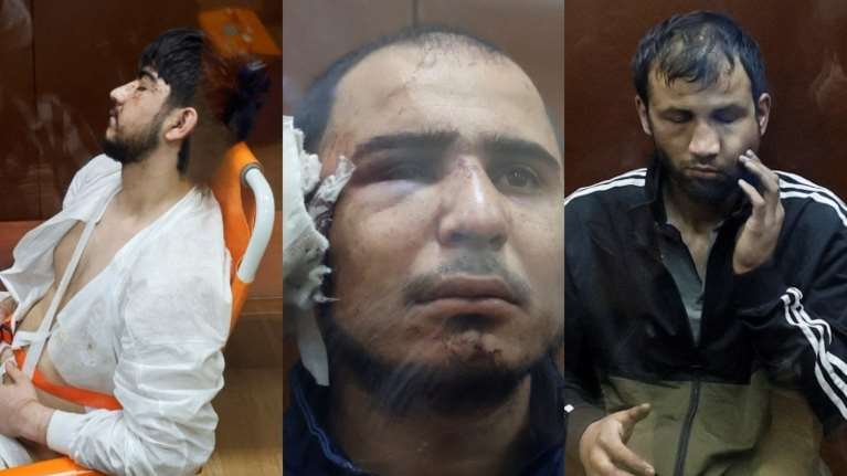 Μακελειό στη Μόσχα: Οι συλληφθέντες έχουν υποστεί άγρια βασανιστήρια - Έκοψαν το αυτί κρατούμενου