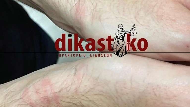 ΕΔΕ μετά την καταγγελία δικηγόρων για επίθεση από αστυνομικούς στα Εξάρχεια - Τους έγδυσαν στο ΑΤ [εικόνες]