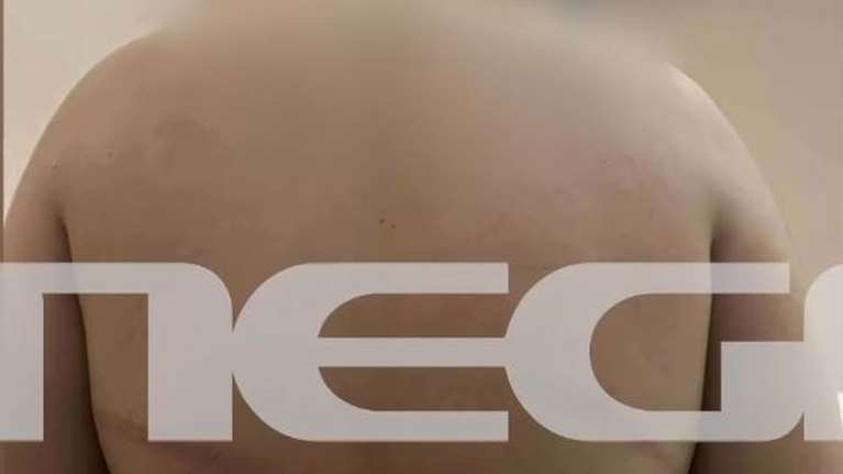 Θεσσαλονίκη: Διαφωνία ανακρίτριας - εισαγγελέα για την προφυλάκιση του 18χρονου που κατηγορείται για τον άγριο ξυλοδαρμό 13χρονου