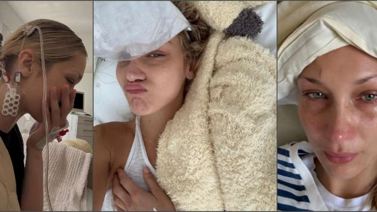 Εξαντλημένη από τη νόσο Lyme η Μπέλα Χαντίντ: Νέες, ανησυχητικές φωτογραφίες του σούπερ μόντελ