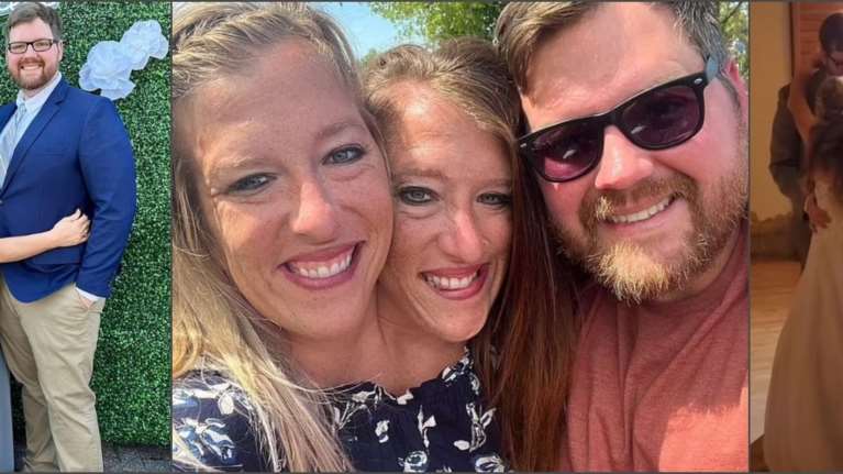 Ενωμένες για μια ζωή: Οι πιο διάσημες σιαμαίες δίδυμες της Αμερικής ντύθηκαν νύφες για τον γάμο της μίας