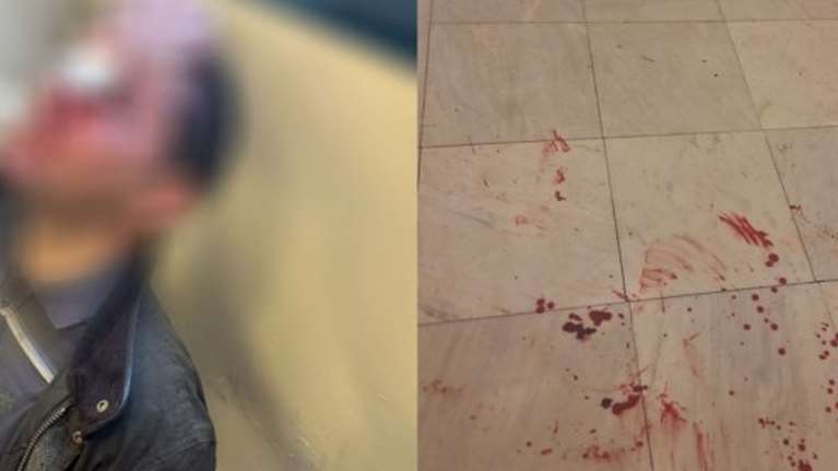 Επίθεση στη Νομική: &quot;Τον χτυπούσαν με κράνη και λοστούς στο κεφάλι&quot; - Τι ψάχνει η ΕΛΑΣ για τους οκτώ δράστες