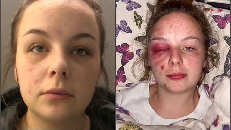 Απίστευτο: Κατά φαντασίαν θύμα βιασμού - Kατηγόρησε ψευδώς τρεις άνδρες φέρνοντάς τους στα πρόθυρα αυτοκτονίας