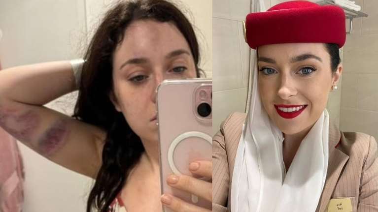 Το όνειρο που έγινε εφιάλτης: 28χρονη Ιρλανδή έγινε αεροσυνοδός, έφυγε για Ντουμπάι και έπεσε σε κακοποιητή σύζυγο