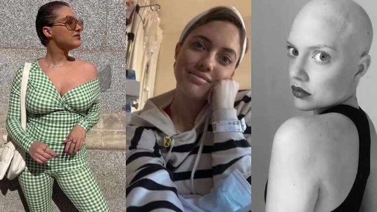 Στα 26 της διαγνώστηκε με μελάνωμα, πάλεψε επί 4 χρόνια αλλά νικήθηκε: Η ιστορία της Πατρίτσια από την Ισπανία έγινε viral