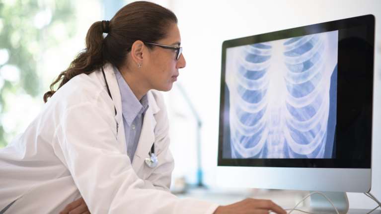 Νέα έρευνα: Για πρώτη φορά οι διαγνώσεις με καρκίνο του πνεύμονα αυξάνονται σε ανθρώπους που δεν έχουν καπνίσει ποτέ