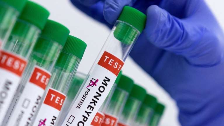 Μpox: Αυξάνεται το επίπεδο συναγερμού από το ECDC μετά και την καταγραφή κρούσματος στη Σουηδία