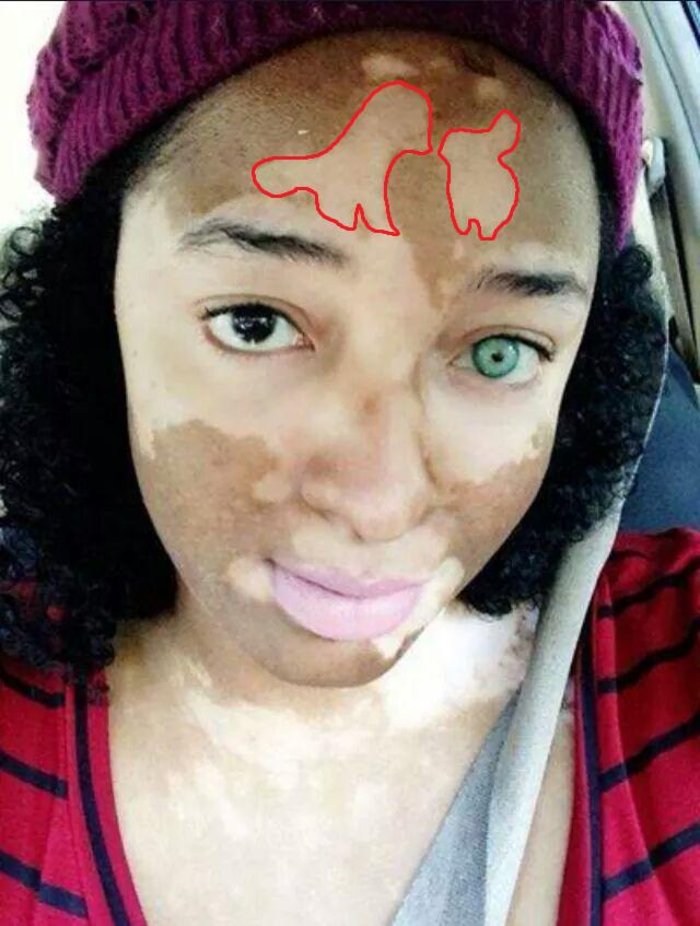 морщины на лице. потеря цвета кожи. потеря цвета кожи.