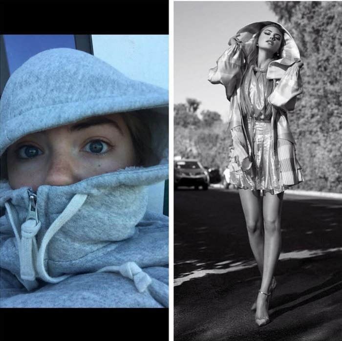High fashion vs reality: Η Κέιτ Απτον τολμά να σπάσει την τέλεια εικόνα της - εικόνα 6