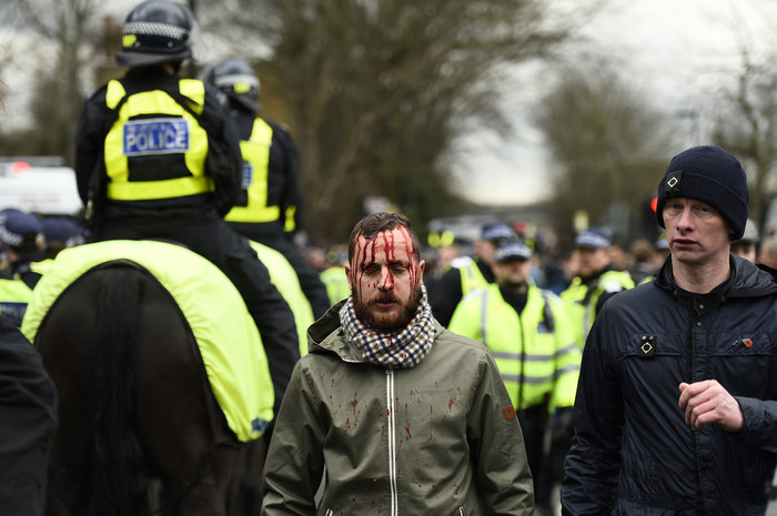 Αγρια επεισόδια στο λονδρέζικο ντέρμπι Τότεναμ- Αρσεναλ - εικόνα 3