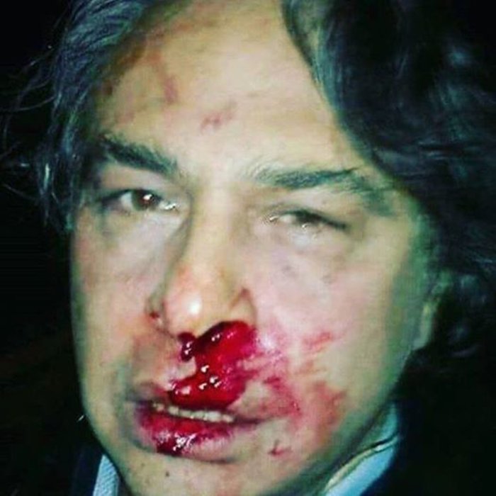 Τουρκία: Συνέλαβαν τον σχεδιαστή μόδας που μίλησε για την Κύπρο