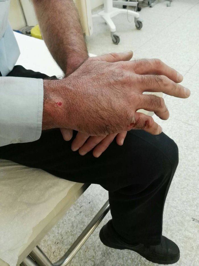 Τραυματίστηκαν αστυνομικοί μετά από επίθεση με μάρμαρα [εικόνες] - εικόνα 2
