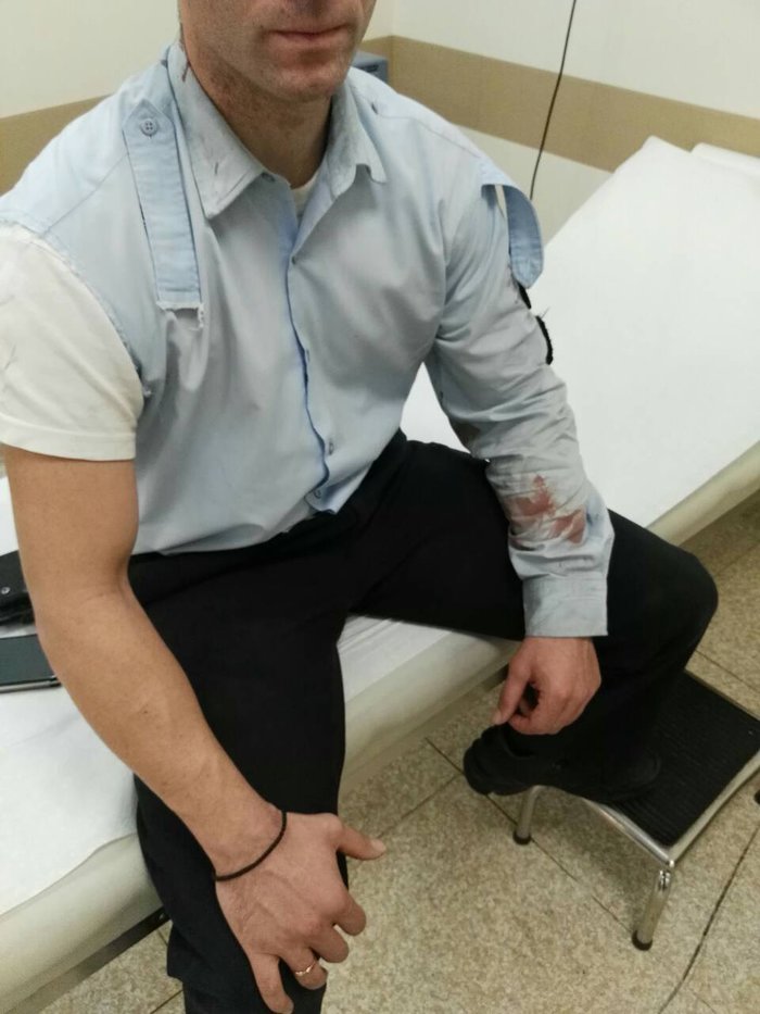 Τραυματίστηκαν αστυνομικοί μετά από επίθεση με μάρμαρα [εικόνες] - εικόνα 3