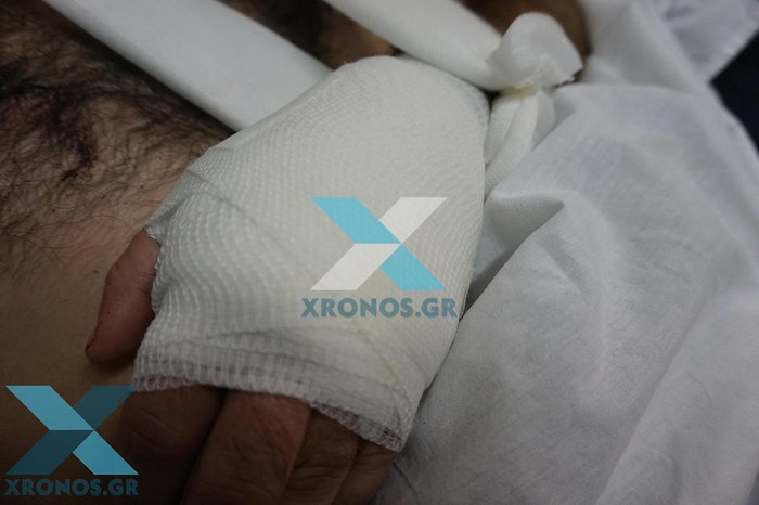 Σοκάρουν οι εικόνες του μαχαιρωμένου αστυνομικού στη Ροδόπη - εικόνα 2